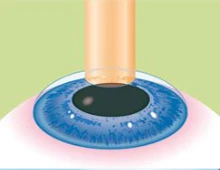 Questions fréquentes.